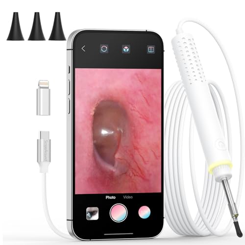 Otoscope for iPhone 15/Android, ScopeAround 3.9mm Ultra-Thin Ear Camera with 6 LED Lights, Digital Otoscope with Ear Wax Removal Tool, USB Plug & Play Ear Wax Camera for Android (No Wi-Fi Needed)