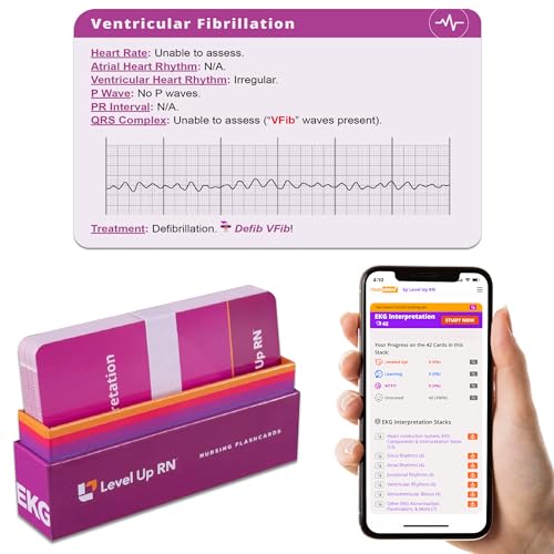 EKG Interpretation Flash Cards – for Nursing/EMT/Paramedic School – 2024 NCLEX ATI HESI Review LPN RN Flash Cards (45 Cards)