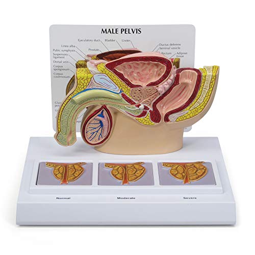 GPI Anatomicals - Human Anatomy Model of Male Pelvis with 3D Prostate Frame, Replica for Anatomy and Physiology Education, Anatomy Model for Doctor's Offices and Classrooms, Medical Study Supplies