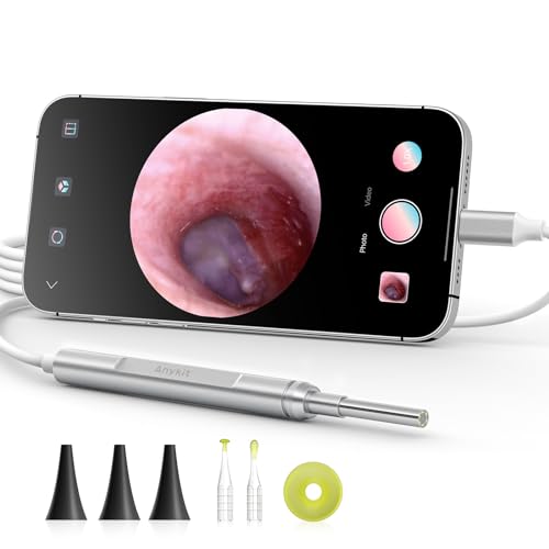 Anykit Digital Otoscope for Phone d & Tablet, Ultra Clear View Ear Camera with Ear Wax Removal Tools, Video Ear Scope Otoscope with Light, Support Capture Photo & Record Videos