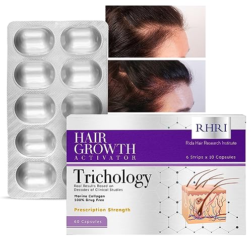 Hair Growth Vitamins for Women, Women's Hair Growth Supplements, Hair Growth Pills,Visibly Thicker & Stronger,Hair Vitamins for Hair Loss for Women, Hair Loss Treatment,Thinning Hair Treatment Women