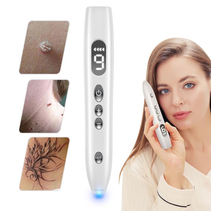 WART Remover,Skin Tag Remover with Replaceable Device to Remove Skin Tags,USB Charging for Home Usage-w1