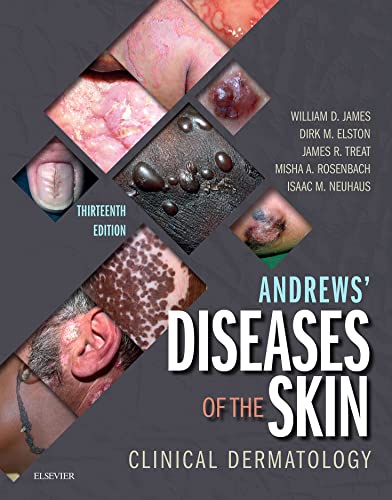 Andrews' Diseases of the Skin: Clinical Dermatology