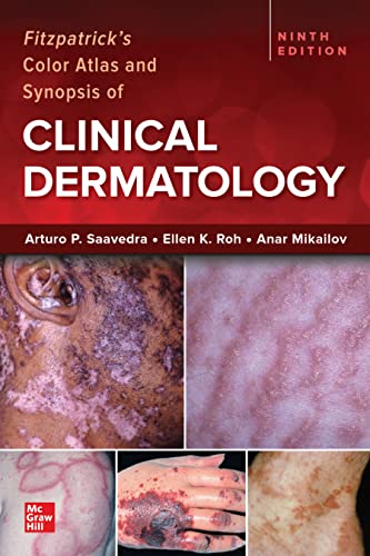 Fitzpatrick's Color Atlas and Synopsis of Clinical Dermatology, Ninth Edition